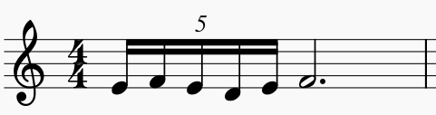 ターン 演奏例4-1
